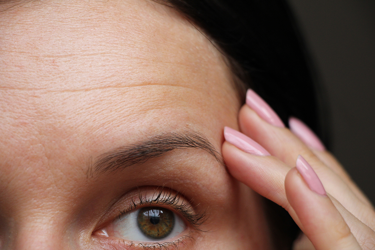 Wrinkles on the forehead