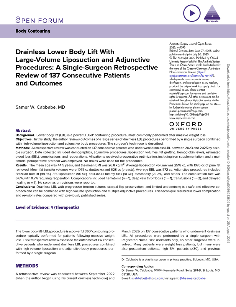 Home 1 dr cabbabe article page